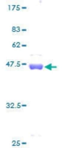 Novus Biologicals Recombinant Human KRAS GST (N-Term) Protein 10 &mu;g | Buy Online | Novus Biologicals&trade; | Fisher Scientific