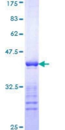 Novus Biologicals Recombinant Human Cytokeratin 10 GST (N-Term) Protein 10 &mu;g | Buy Online | Novus Biologicals&trade; | Fisher Scientific