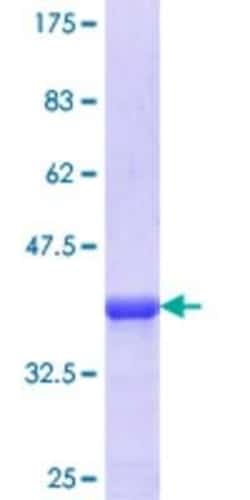 Novus Biologicals Recombinant Human Cytokeratin 13 GST (N-Term) Protein 10 &mu;g | Buy Online | Novus Biologicals&trade; | Fisher Scientific