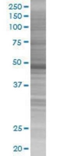 Novus Biologicals Cytokeratin 17 293T Cell Transient Overexpression Lysate 0.1 mL | Buy Online | Novus Biologicals&trade; | Fisher Scientific