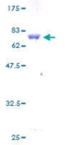 Novus Biologicals Recombinant Human KRTHA3B GST (N-Term) Protein 25 &mu;g | Buy Online | Novus Biologicals&trade; | Fisher Scientific