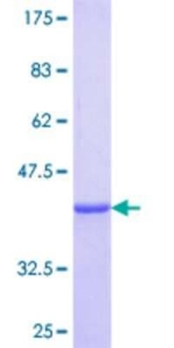 Novus Biologicals Recombinant Human KRT34 GST (N-Term) Protein 25 &mu;g | Buy Online | Novus Biologicals&trade; | Fisher Scientific