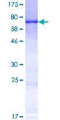 Novus Biologicals Recombinant Human KRT35 GST (N-Term) Protein 25 &mu;g | Buy Online | Novus Biologicals&trade; | Fisher Scientific