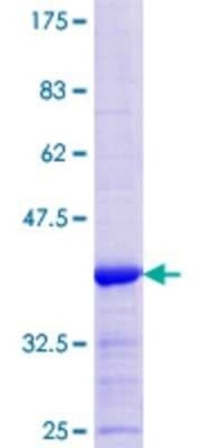 Novus Biologicals Recombinant Human LAD1 GST (N-Term) Protein 10 &mu;g | Buy Online | Novus Biologicals&trade; | Fisher Scientific