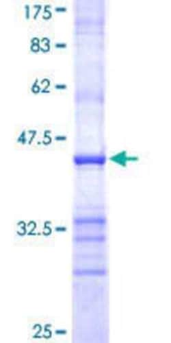 Novus Biologicals Recombinant Human Lactalbumin Alpha GST (N-Term) Protein 25 &mu;g | Buy Online | Novus Biologicals&trade; | Fisher Scientific