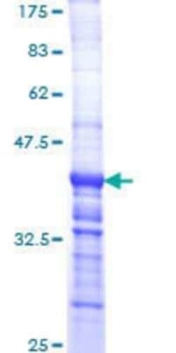 Novus Biologicals Recombinant Human Laminin alpha 2 GST (N-Term) Protein 25 &mu;g | Buy Online | Novus Biologicals&trade; | Fisher Scientific