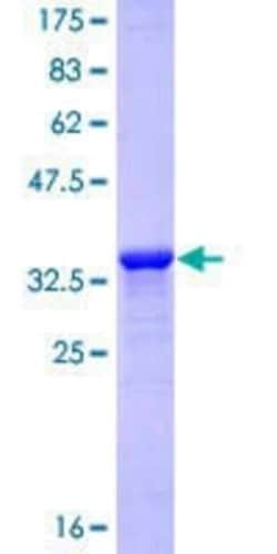 Novus Biologicals Recombinant Human Laminin alpha 3 GST (N-Term) Protein 25 &mu;g | Buy Online | Novus Biologicals&trade; | Fisher Scientific