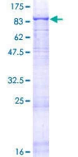 Novus Biologicals Recombinant Human Laminin alpha 5 GST (N-Term) Protein 2 &mu;g | Buy Online | Novus Biologicals&trade; | Fisher Scientific