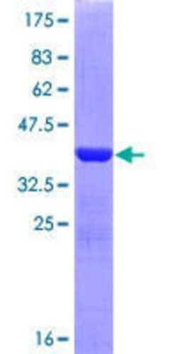 Novus Biologicals Recombinant Human Laminin beta 3 GST (N-Term) Protein 25 &mu;g | Buy Online | Novus Biologicals&trade; | Fisher Scientific