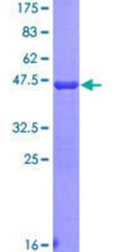 Novus Biologicals Recombinant Human RPSA GST (N-Term) Protein 25 &mu;g | Buy Online | Novus Biologicals&trade; | Fisher Scientific