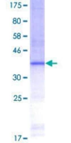 Novus Biologicals Recombinant Human Lactase GST (N-Term) Protein 25 &mu;g | Buy Online | Novus Biologicals&trade; | Fisher Scientific
