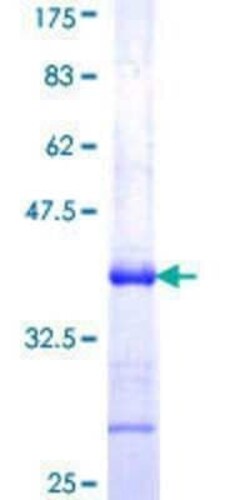 Novus Biologicals Recombinant Human LIM1 GST (N-Term) Protein 25 &mu;g | Buy Online | Novus Biologicals&trade; | Fisher Scientific