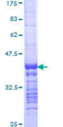Novus Biologicals Recombinant Human DNA Ligase I GST (N-Term) Protein 25 &mu;g | Buy Online | Novus Biologicals&trade; | Fisher Scientific