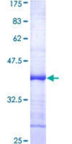 Novus Biologicals Recombinant Human DNA Ligase IV GST (N-Term) Protein 25 &mu;g | Buy Online | Novus Biologicals&trade; | Fisher Scientific