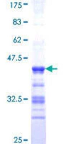 Novus Biologicals Recombinant Human ABLIM1 GST (N-Term) Protein 25 &mu;g | Buy Online | Novus Biologicals&trade; | Fisher Scientific