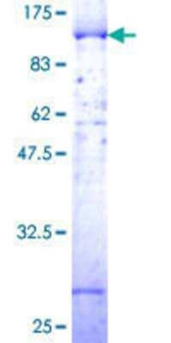 Novus Biologicals Recombinant Human LIM Kinase 1 GST (N-Term) Protein 2 &mu;g | Buy Online | Novus Biologicals&trade; | Fisher Scientific