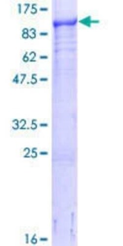 Novus Biologicals Recombinant Human LIM kinase 2 GST (N-Term) Protein 25 &mu;g | Buy Online | Novus Biologicals&trade; | Fisher Scientific