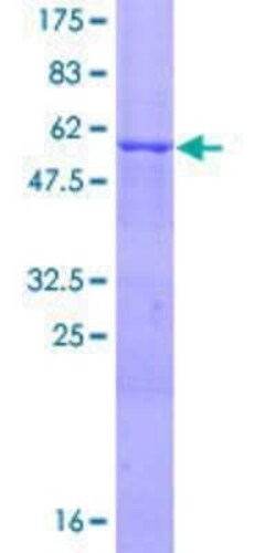 Novus Biologicals Recombinant Human PINCH1/LIMS1 GST (N-Term) Protein 10 &mu;g | Buy Online | Novus Biologicals&trade; | Fisher Scientific