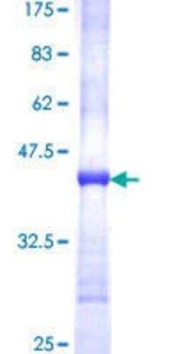 Novus Biologicals Recombinant Human FADS1 GST (N-Term) Protein 25 &mu;g | Buy Online | Novus Biologicals&trade; | Fisher Scientific