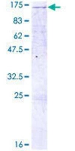 Novus Biologicals Recombinant Human LLGL2 GST (N-Term) Protein 2 &mu;g | Buy Online | Novus Biologicals&trade; | Fisher Scientific