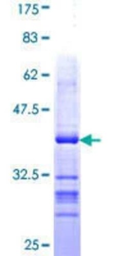 Novus Biologicals Recombinant Human Lgl1 GST (N-Term) Protein 25 &mu;g | Buy Online | Novus Biologicals&trade; | Fisher Scientific