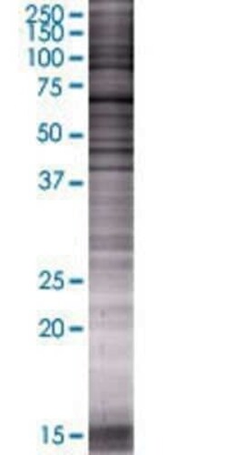 Novus Biologicals Lamin B1 293T Cell Transient Overexpression Lysate 0.1 mL | Buy Online | Novus Biologicals&trade; | Fisher Scientific