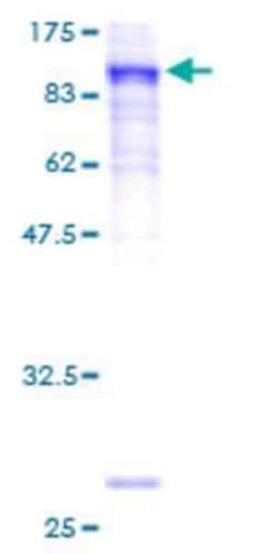 Novus Biologicals Recombinant Human PRICKLE3 GST (N-Term) Protein 25 &mu;g | Buy Online | Novus Biologicals&trade; | Fisher Scientific