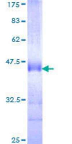 Novus Biologicals Recombinant Human LMO7 GST (N-Term) Protein 25 &mu;g | Buy Online | Novus Biologicals&trade; | Fisher Scientific