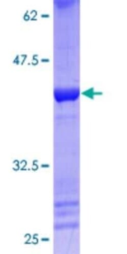Novus Biologicals Recombinant Human LMX1A GST (N-Term) Protein 25 &mu;g | Buy Online | Novus Biologicals&trade; | Fisher Scientific