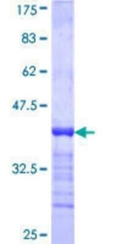Novus Biologicals Recombinant Human Breast cancer suppressor candidate 1 GST (N-Term) Protein 2 &mu;g | Buy Online | Novus Biologicals&trade; | Fisher Scientific