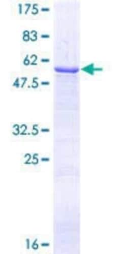Novus Biologicals Recombinant Human LRP-1 GST (N-Term) Protein 10 &mu;g | Buy Online | Novus Biologicals&trade; | Fisher Scientific