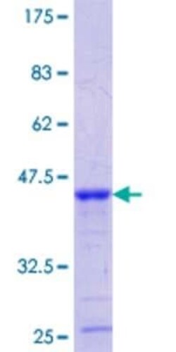 Novus Biologicals Recombinant Human LRP3 GST (N-Term) Protein 25 &mu;g | Buy Online | Novus Biologicals&trade; | Fisher Scientific