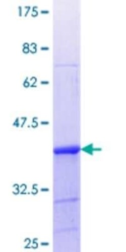 Novus Biologicals Recombinant Human LSP1 GST (N-Term) Protein 10 &mu;g | Buy Online | Novus Biologicals&trade; | Fisher Scientific