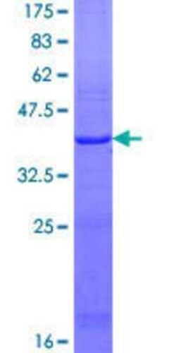 Novus Biologicals Recombinant Human LSS GST (N-Term) Protein 10 &mu;g | Buy Online | Novus Biologicals&trade; | Fisher Scientific