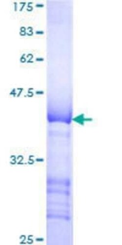 Novus Biologicals Recombinant Human Latent TGF-beta bp1 GST (N-Term) Protein 10 &mu;g | Buy Online | Novus Biologicals&trade; | Fisher Scientific