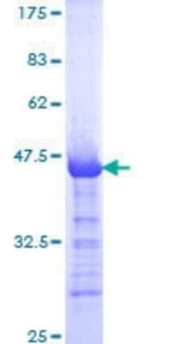Novus Biologicals Recombinant Human Latent TGF-beta bp2/LTBP-2 GST (N-Term) Protein 10 &mu;g | Buy Online | Novus Biologicals&trade; | Fisher Scientific