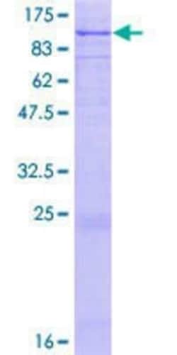 Novus Biologicals Recombinant Human Lactoferrin GST (N-Term) Protein 2 &mu;g | Buy Online | Novus Biologicals&trade; | Fisher Scientific