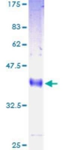 Novus Biologicals Recombinant Human Ly-6H GST (N-Term) Protein 10 &mu;g | Buy Online | Novus Biologicals&trade; | Fisher Scientific