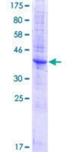 Novus Biologicals Recombinant Human TM4SF1/L6 GST (N-Term) Protein 10 &mu;g | Buy Online | Novus Biologicals&trade; | Fisher Scientific
