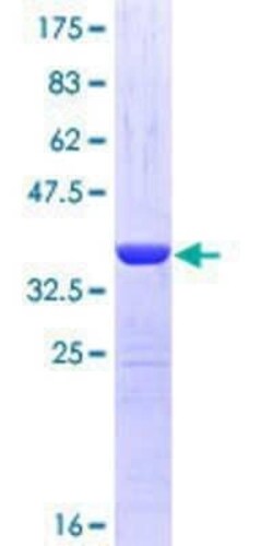 Novus Biologicals Recombinant Human NBR1 GST (N-Term) Protein 25 &mu;g | Buy Online | Novus Biologicals&trade; | Fisher Scientific