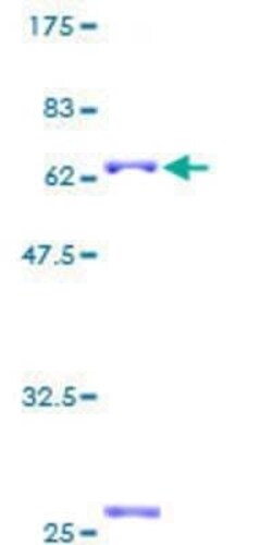 Novus Biologicals Recombinant Human Protein mab-21-like 1 GST (N-Term) Protein 2 &mu;g | Buy Online | Novus Biologicals&trade; | Fisher Scientific