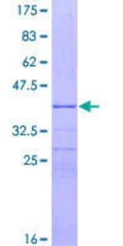 Novus Biologicals Recombinant Human Protein mab-21-like 1 GST (N-Term) Protein 10 &mu;g | Buy Online | Novus Biologicals&trade; | Fisher Scientific