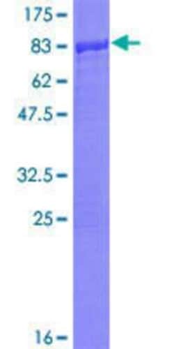 Novus Biologicals Recombinant Human Smad1 GST (N-Term) Protein 10 &mu;g | Buy Online | Novus Biologicals&trade; | Fisher Scientific