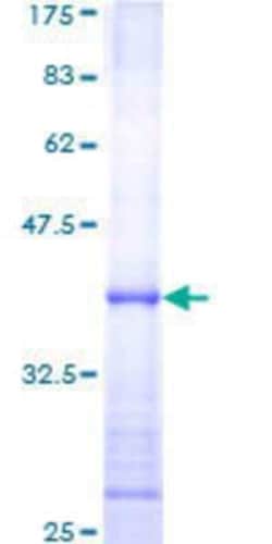 Novus Biologicals&trade;&nbsp;Recombinant Human Smad1 GST (N-Term) Protein