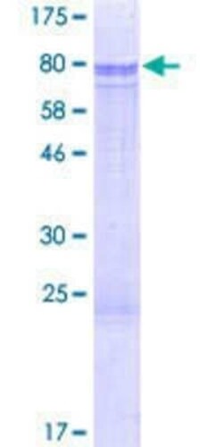 Novus Biologicals Recombinant Human Smad5 GST (N-Term) Protein 2 &mu;g | Buy Online | Novus Biologicals&trade; | Fisher Scientific