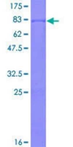Novus Biologicals Recombinant Human Smad9 GST (N-Term) Protein 2 &mu;g | Buy Online | Novus Biologicals&trade; | Fisher Scientific
