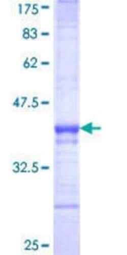 Novus Biologicals Recombinant Human c-Maf GST (N-Term) Protein 10 &mu;g | Buy Online | Novus Biologicals&trade; | Fisher Scientific