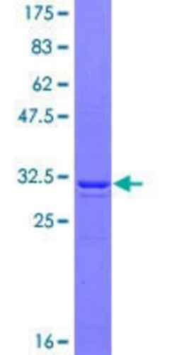 Novus Biologicals Recombinant Human MAGEA1 GST (N-Term) Protein 25 &mu;g | Buy Online | Novus Biologicals&trade; | Fisher Scientific
