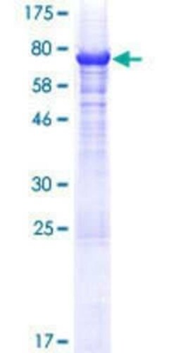Novus Biologicals Recombinant Human MAGEA10 GST (N-Term) Protein 25 &mu;g | Buy Online | Novus Biologicals&trade; | Fisher Scientific