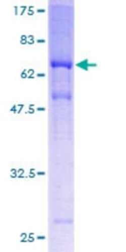Novus Biologicals Recombinant Human MAGEA11 GST (N-Term) Protein 25 &mu;g | Buy Online | Novus Biologicals&trade; | Fisher Scientific